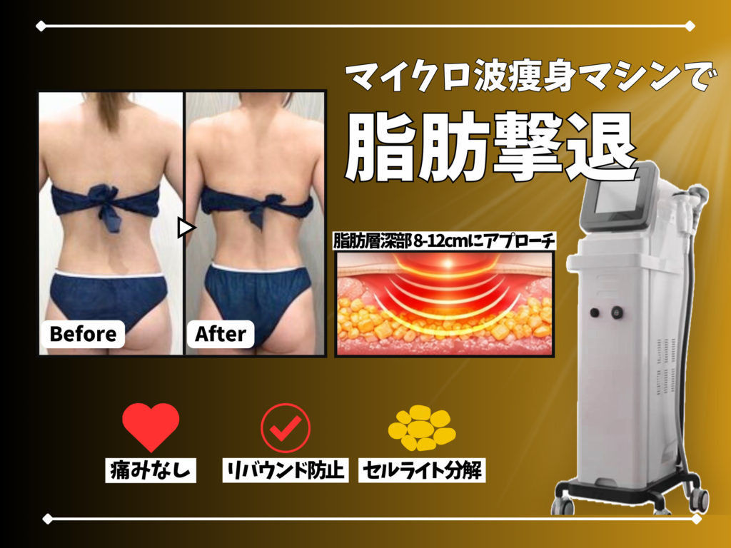 テトラセレストを使用したマイクロ波痩身の紹介画像