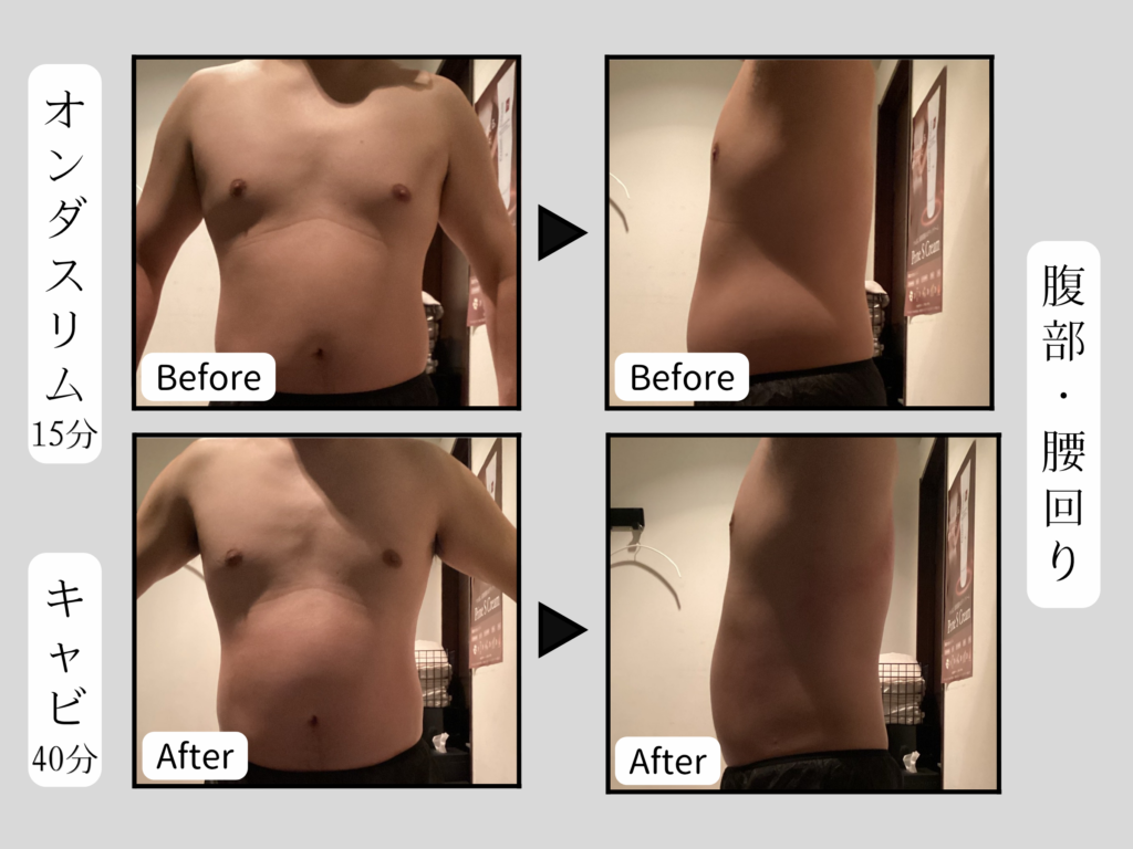 オンダスリムビフォーアフター